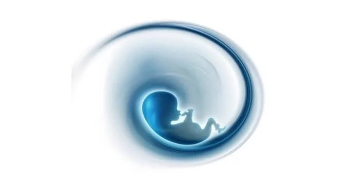 abortion